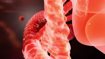 Corona infection, coronavirus covid-19 virus