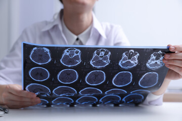 Doctor examining MRI images of patient with multiple sclerosis at table in clinic, closeup