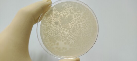 Bacillus subtilis growth picture