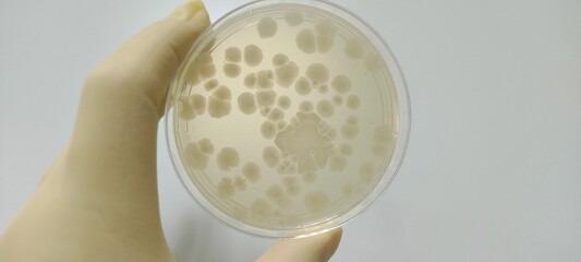 Bacillus subtilis growth picture - obrazy, fototapety, plakaty