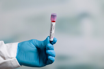 Close up of hands in medical gloves holding a test tube after virus analysis with omicron result...