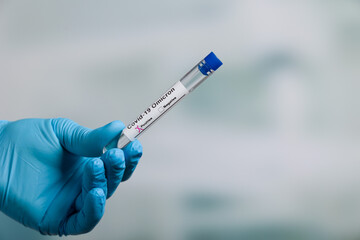 Close up of hands in medical gloves holding a test tube after virus analysis with omicron result...