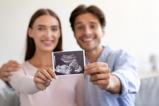 Smiling young attractive european wife and husband hold ultrasound scan picture unborn baby in room