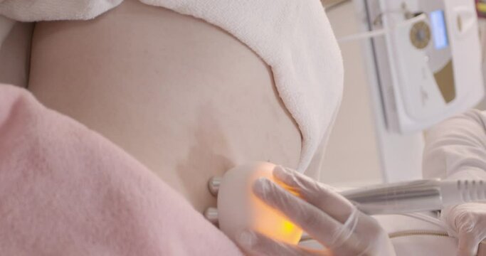 
Radiofrequency application in aesthetic clinic on the abdomen of a Caucasian woman, 4k resolution, aesthetic videos, aesthetic clinic, aesthetics