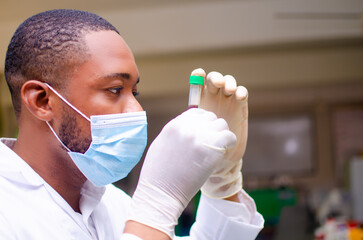 close up of african doctor in the lab closely looking at the vaccine on his hand