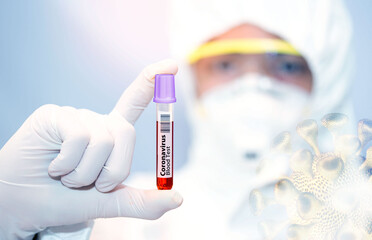 Obraz premium Coronavirus 2019-nCoV Blood Sample. New Epidemic Corona Virus. Corona virus outbreaking.