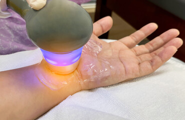 Treatment of hand and wrist injuries and numbness of the hands and nerves Method of treatment with...
