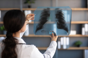 Young indian woman doctor in white coat looks at x-ray picture of lungs in office clinic interior, back