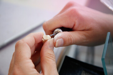 hände einer zahntechnikerin, die eine prothese bearbeitet