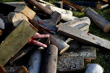 man injured with ax while working with wood for heating. blood and severed fingers in a pile of cut...