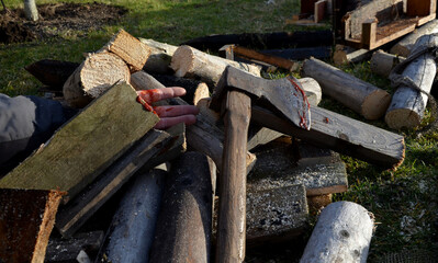 man injured with ax while working with wood for heating. blood and severed fingers in a pile of cut...