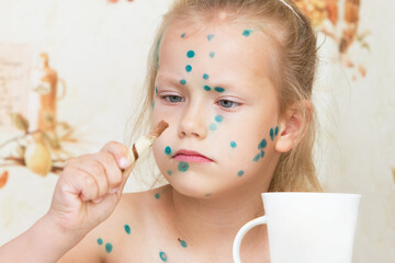 Girl sick with chickenpox, eats