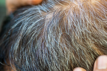 Gray hair problems in older men, old asian senior man with gray hair, white hair or hair loss problem