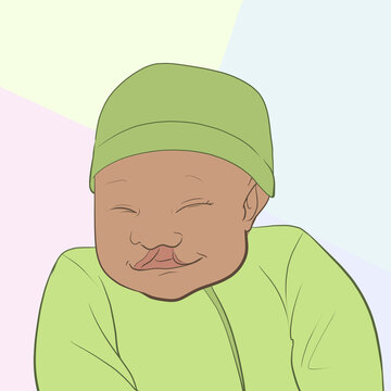 Baby with Cleft Pallet 