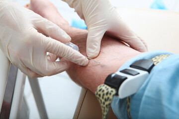 The patient gives blood for analysis. A syringe in the hands of a nurse. Close-up. Medical laboratory. Unrecognizable persons. Just the hands.