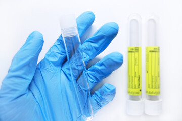 Test-tube for taking biomaterials in a doctor's hand in blue medical glove. Medical urine...