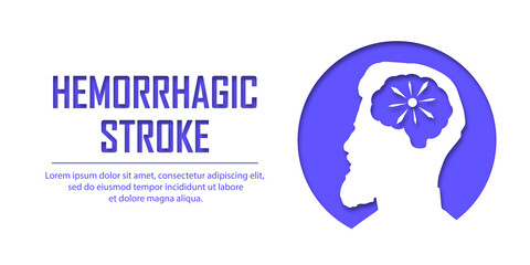 People suffering from hemorrhagic stroke. Hemorrhagic stroke patient concept. Medical help. People silhouette in paper cut style. Stroke types poster, banner. medical vector illustration
