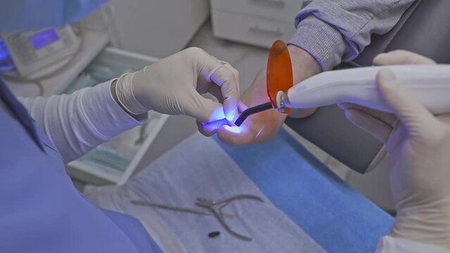 A doctor in gloves heats a corrective bracket with a laser corrects problems and diseases of the nail, an ingrown, deformed nail, a sore finger, performs procedures treatment prevention nail diseases