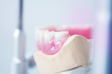 Fototapeta na wymiar Modellierungf einer Zahnprothese, Gebiss vor hellem Hintergrund