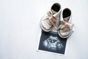 Pink baby girl shoes standing next to ultrasound image isolated on white background. To simulate...
