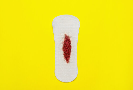 Sanitary Pad With Red Glitter On Yellow Background, Top View. Menstrual Cycle