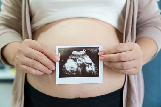 A cute pregnant belly and x-ray ultrasound scan of baby. Pregnant female motherhood concept. pregnant belly body part.