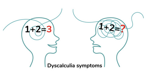Dyscalculia symptoms. Head silhouette with mathematical examples. Illustration isolated on white background. - obrazy, fototapety, plakaty