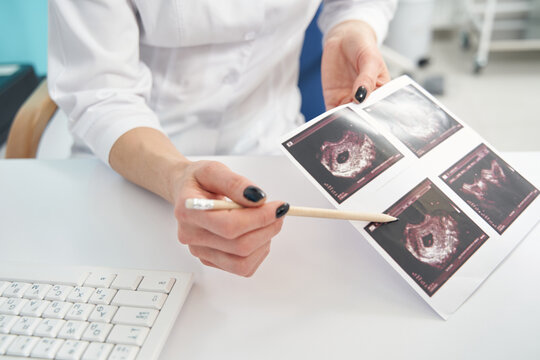 Doctor demonstrating first trimester ultrasound images of her patient