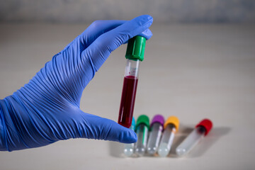Muestra de sangre sostenida por mano de bioquímico con guantes azules. 