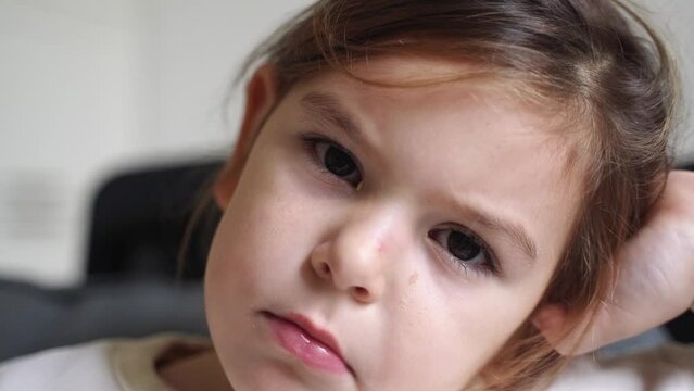 Close up of child ill with conjunctivitis, red eye with pus