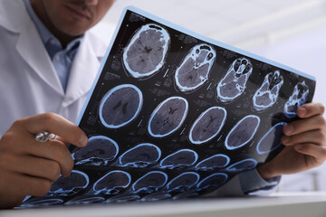 Doctor examining MRI images of patient with multiple sclerosis at table in clinic, closeup - obrazy, fototapety, plakaty