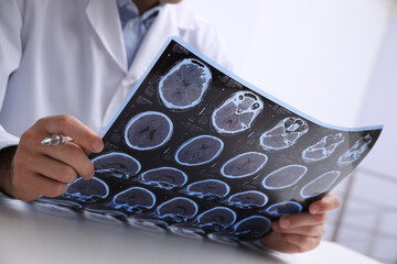 Doctor examining MRI images of patient with multiple sclerosis at table in clinic, closeup - obrazy, fototapety, plakaty