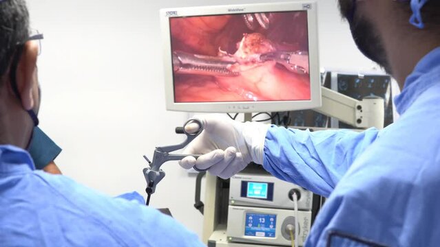 Back view of surgeons team looks at monitors while preforming operation in hospital operating theater