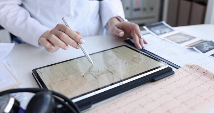 Cardiologist examines patient electrocardiogram on tablet closeup