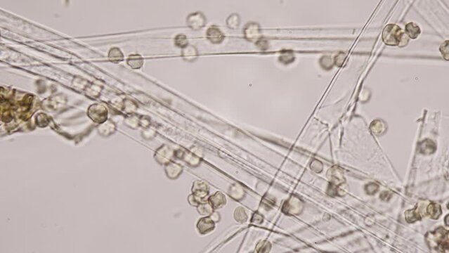 Mold or Mould. Mold spherical spores close-up. Reproduction in the kingdom of fungi. Fungus grows in the form of multicellular filaments called hyphae. Toxic compounds or mycotoxins are produced by mo