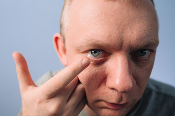 Man putting on the contact lens with fingers. Advertising of contact lenses for vision improvement. Optical shop, health care and medicine concept