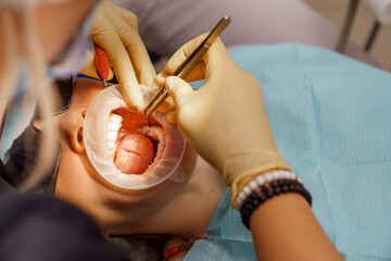 real. dentist prepares for treatment of patient's teeth