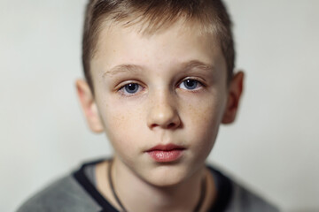 close-up portrait of serious caucasian boy with freckles in casual wear