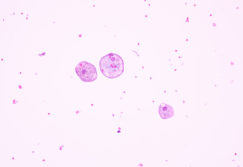 Blood smear shows macrophages on white background view in microscope.Medical background.Macrophages...