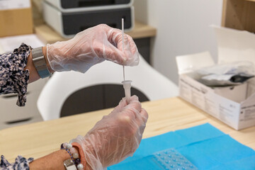 test antigénique-dépistage Covid-19
