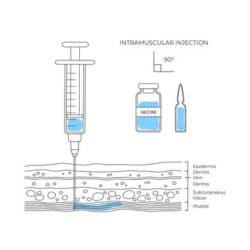 Types of injections. Guide to injecting vaccines into skin. Vector medical procedure manuals for hospital workers