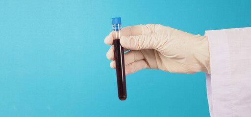 The doctor's hand is holding blood test tubes and wearing white latex gloves on blue background.