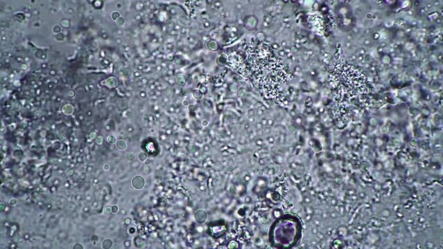 Footage taken with a microscope. Enlarged image. Cells in the body, the movement and vital activity of cells. Science and medicine background