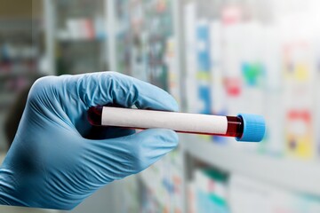 Medical laboratory assistant holding tube, Omicron COVID-19 concept