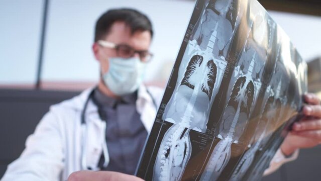 Male doctor examines x-ray of patient chest with CT scan film. Detection of body x-ray test on COVID-19, mri scan for coronavirus virus epidemic spread concept. Theme lung radiography.