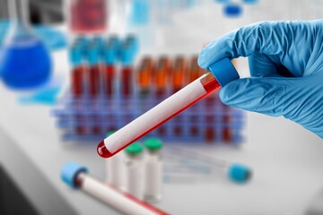 Hand of doctor holding a blood test tube during covid-19 outbreak. New strain or varinat...