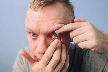 Man inserting clear transparent contact lens in eye. Correction of myopia eyesight
