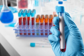 Biochemist hold test tubes with blood sample for test.