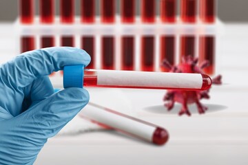 Test tube of blood for Covid-19 Variant test, blood sample with a New Variant