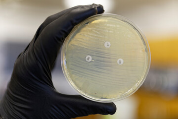 A Pertri plate showing the resistance of bacteria to antibiotics. If the bacteria is resistant the zone of inhibition will not form.